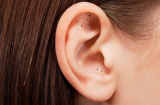 Mụn mọc trong tai: Cẩn thận kiểu gây ra biến chứng nguy hiểm