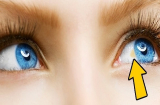 Nhận biết các bệnh nguy hiểm qua những dấu hiệu bất thường ở đôi mắt