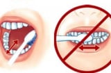 Thói quen đánh răng sai lầm 90% người mắc phải