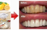 5 cách làm trắng răng đơn giản mà hiệu quả từ những nguyên liệu dễ kiếm trong nhà bếp