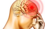 Nguyên nhân, triệu chứng của chấn thương sọ não