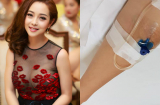 Hoa hậu Jennifer Phạm phải nhập viện cấp cứu mổ viêm ruột thừa vì chủ quan