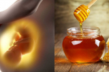 Ngừa biến chứng thai nhi, bổ não gấp 5 lần sữa, mẹ bầu chỉ cần uống 1 ly mật ong mỗi sáng.