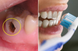 Những lưu ý khi chải răng cần biết nếu không có chải cũng như không