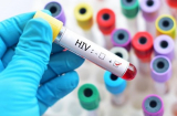 Nhận định ban đầu nguyên nhân của 42 người nhiễm HIV ở làng Kim Thượng