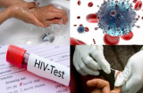 Xử lý cấp tốc khi nghi ngờ bị PHƠI NHIỄM HIV mà ai cũng phải biết