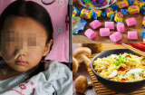 Bé gái 10 tuổi tại trung Quốc bị ung thư tuyến giáp vì thường xuyên ăn 3 món trẻ em Việt nào cũng thích