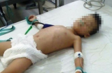 Bé trai 5 tuổi bị người tình của mẹ bạo hành đến hôn mê nguy kịch