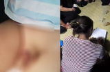 Bé trai bị tổn thương vùng kín nghiêm trọng sau khi đi học mầm non về nhà