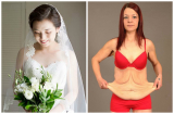 Cô dâu trẻ muốn mặc vừa váy cưới yêu thích đã giảm 7,5kg trong 1 tuần và kết quả ai cũng phải giật mình
