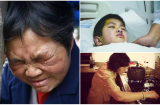 Cậu bé 7 tuổi bị ung thư gan giai đoạn cuối, thủ phạm chính là chất độc trong bếp hầu hết gia đình Việt