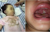 Mới 14 tháng bé đau họng đã t.ử v.ong, bác sĩ cảnh báo thiếu sót ch.ết người của mẹ mà nhiều người cũng mắc