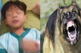 Xót xa bé trai mới 5 tuổi chết do chó dại cắn: “Con sợ ba mẹ biết không dám nói”