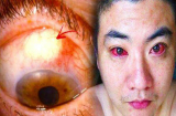 Cảnh báo: Ung thư, mù mắt chỉ vì thói quen sử dụng điện thoại vào ban đêm