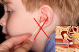 Cảnh báo: 'Quái vật' trong lỗ tai khiến bé không nghe, chậm nói, bố mẹ cần diệt ngay kẻo trễ