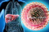 5 món đồ nếu dùng chung dễ gây lây nhiễm viêm gan B nhanh thần tốc: Hãy cẩn thận!