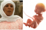 Sản phụ mang bầu 46 năm mới đẻ hình dạng đứa trẻ sau khi sinh khiến ai cũng “sốc”