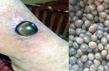 Sự thật về hạt đậu Lào được ví như THẦN DƯỢC “chữa bách bệnh”: Chuyên gia TIẾT LỘ điều này khiến bạn “ngã ngửa”