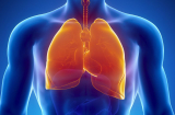 Lọc phổi sạch bong nhờ 5 món ăn bình dân nhưng mạnh như 'máy hút bụi', thải mọi độc tố ra khỏi cơ thể
