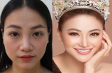 Hoa hậu Phương Khánh gây sốc với số lần phẫu thuật thẩm mỹ để có nhan sắc như hiện tại