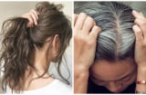 5 dấu hiệu khác thường trên mái tóc ngầm cảnh báo sức khoẻ xuống cấp, số 1 rất nhiều người mắc