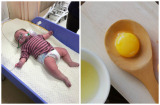 Bé 6,5 tháng ăn trứng xong suy hô hấp: BS cảnh báo dấu hiệu dị ứng mẹ cần biết để con không nguy hiểm
