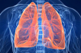 Điểm danh 5 thực phẩm giải độc và làm sạch phổi giúp phòng tránh ung thư hiệu quả số 1