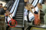 Bất ngờ bị “nuốt” vào thang cuốn khi đi mua sắm, người phụ nữ phải cắt bỏ một bên chân