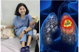 Mai Phương phải trợ thở bằng máy vì ung thư di căn vào tim: Ung thư phổi nguy hiểm thế nào?