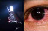Cảnh báo: Bị đột quỵ mắt do liên tục dùng điện thoại trong đêm trước khi ngủ