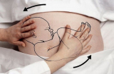 Xem bác sĩ dùng tay xoay thai nhi ngôi ngược trong bụng mẹ