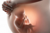 Những tác nhân độc hại mà mẹ bầu dễ tiếp xúc, không cẩn thận sẽ gây dị tật thai nhi
