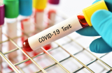 Những con đường lây nhiễm của Covid-19 và biện pháp phòng ngừa dịch bệnh