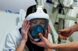 Thiếu máy trợ thở cho bệnh nhân nhiễm Covid-19 nặng, bệnh viện thay thế bằng mặt nạ lặn biển