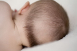 Rụng tóc ở trẻ nhỏ có phải biểu hiện trẻ bị suy dinh dưỡng hay không?