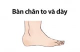 Tướng bàn chân phụ nữ đi trên nhung lụa, cả đời hưởng trọn vinh hoa phú quý