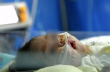 Bé 2 tháng tuổi bị xuất huyết não, bác sĩ chỉ ra thói quen kiêng cữ tai hại của mẹ