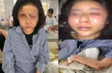Chân dung cô gái trẻ xinh đẹp bị tra tấn, đánh đập dã man suốt 2 tiếng