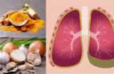 8 loại thực phẩm bảo vệ phổi, tăng cường hệ miễn dịch