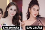 Phương Oanh tự so sánh nhan sắc sau khi phẫu thuật thẩm mỹ, thừa nhận ngày càng xinh đẹp hơn