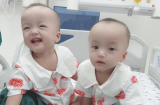 Cặp sinh đôi Trúc Nhi- Diệu Nhi chính thức xuất viện sau 84 ngày được tách rời