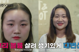 Stylist xứ Hàn bày cách 'chữa cháy' cho mái tóc mỏng dính, từng sợi thưa thớt