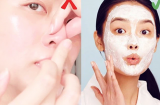 Bỏ túi ngay 5 công thức mặt nạ trị mụn đầu đen cứng đầu trả lại làn da láng mịn