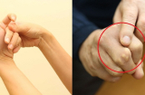 Bẻ khớp ngón tay để giãn gân cốt: Tưởng vô hại nhưng gây ra 1 căn bệnh đáng sợ