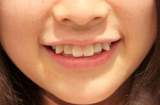 Phụ nữ sở hữu 3 tướng răng này chứng tỏ số khổ, hay gặp thị phi