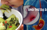 5 loại rau được WHO liệt vào danh sách gây ung thư bảng A: Xếp thứ 2 là món khoái khẩu của người Việt