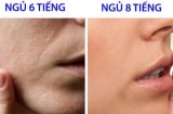 10 thói quen khiến phụ nữ nhanh già, da đầy mụn và nếp nhăn