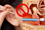 4 thói quen làm hại tai của bạn, ảnh hưởng não bộ nhưng nhiều người Việt vẫn phạm phải