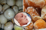 Chuyên gia cảnh báo: 3 món ăn quen thuộc dễ gây ung thư, hàng triệu người Việt vẫn ăn mỗi ngày
