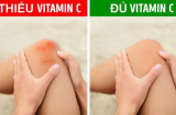 8 dấu hiệu cảnh báo bạn thiếu vitamin C trầm trọng